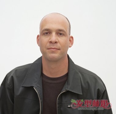 男性雄性激素过多脱发吗 中年男人脱发的原因