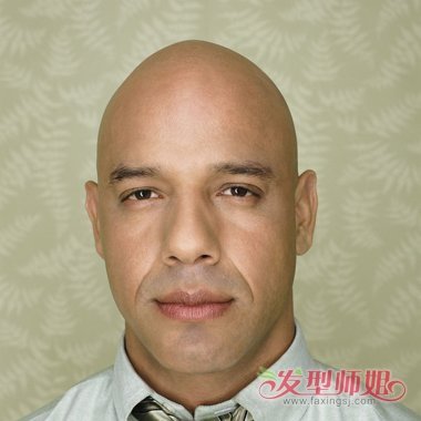 男性雄性激素过多脱发吗 中年男人脱发的原因