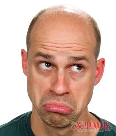 男性雄性激素过多脱发吗 中年男人脱发的原因